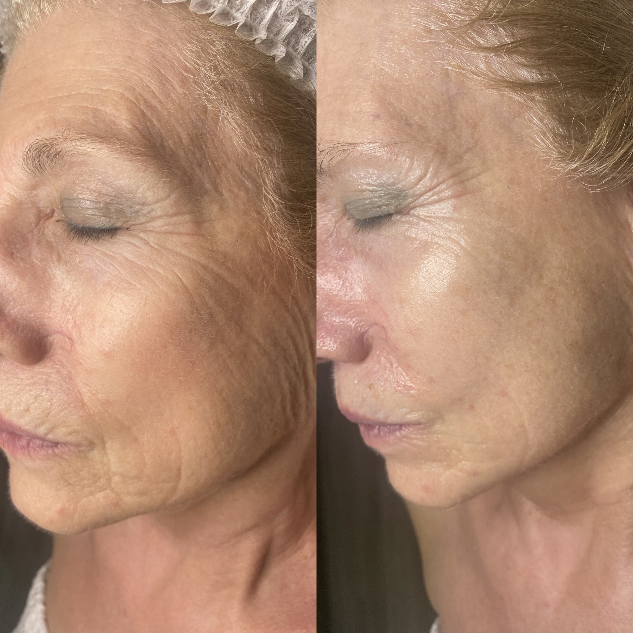 До после 2jpg